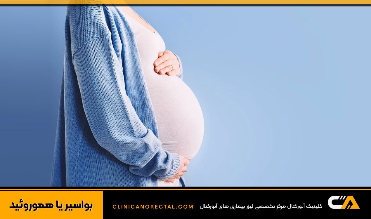 درمان بواسیر در بارداری چگونه است